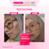 KITSUI Pop White Probiotic 17's x 2g | Berry Probiotic Supplement for Skin Glow, Bright & Radiant Skin, Skin Hydration & Antioxidant Support