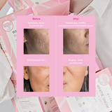 Kitsui Whitie Snow Biotic + Vit C (15gx15s)