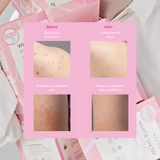 Kitsui Whitie Snow Biotic + Vit C (15gx15s)