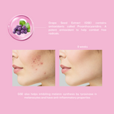 [Double Deals] 2x Whitie Snow 17's x 15g | Probiotic | Prebiotic | Pencerahan Kulit | Niacinamide
