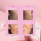 [Double Deals] 2x Whitie Snow 17's x 15g | Probiotic | Prebiotic | Pencerahan Kulit | Niacinamide