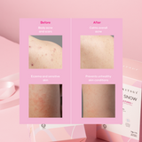 [Double Deals] 2x Whitie Snow 17's x 15g | Probiotic | Prebiotic | Pencerahan Kulit | Niacinamide